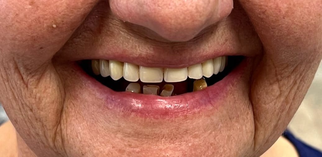 1-antes.jpg 1-antes.jpg