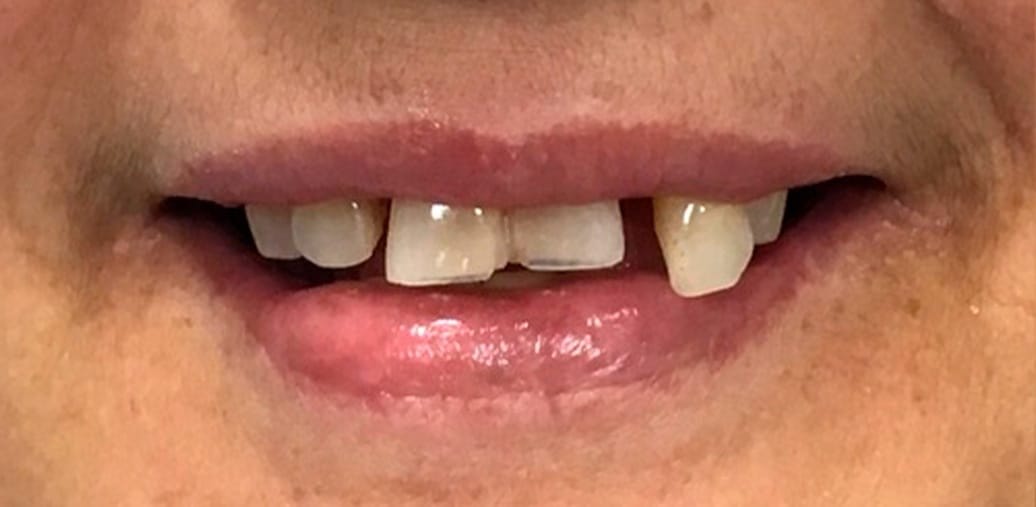 2-antes.jpg 2-antes.jpg