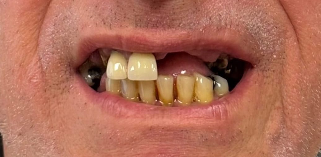 3-antes.jpg 3-antes.jpg