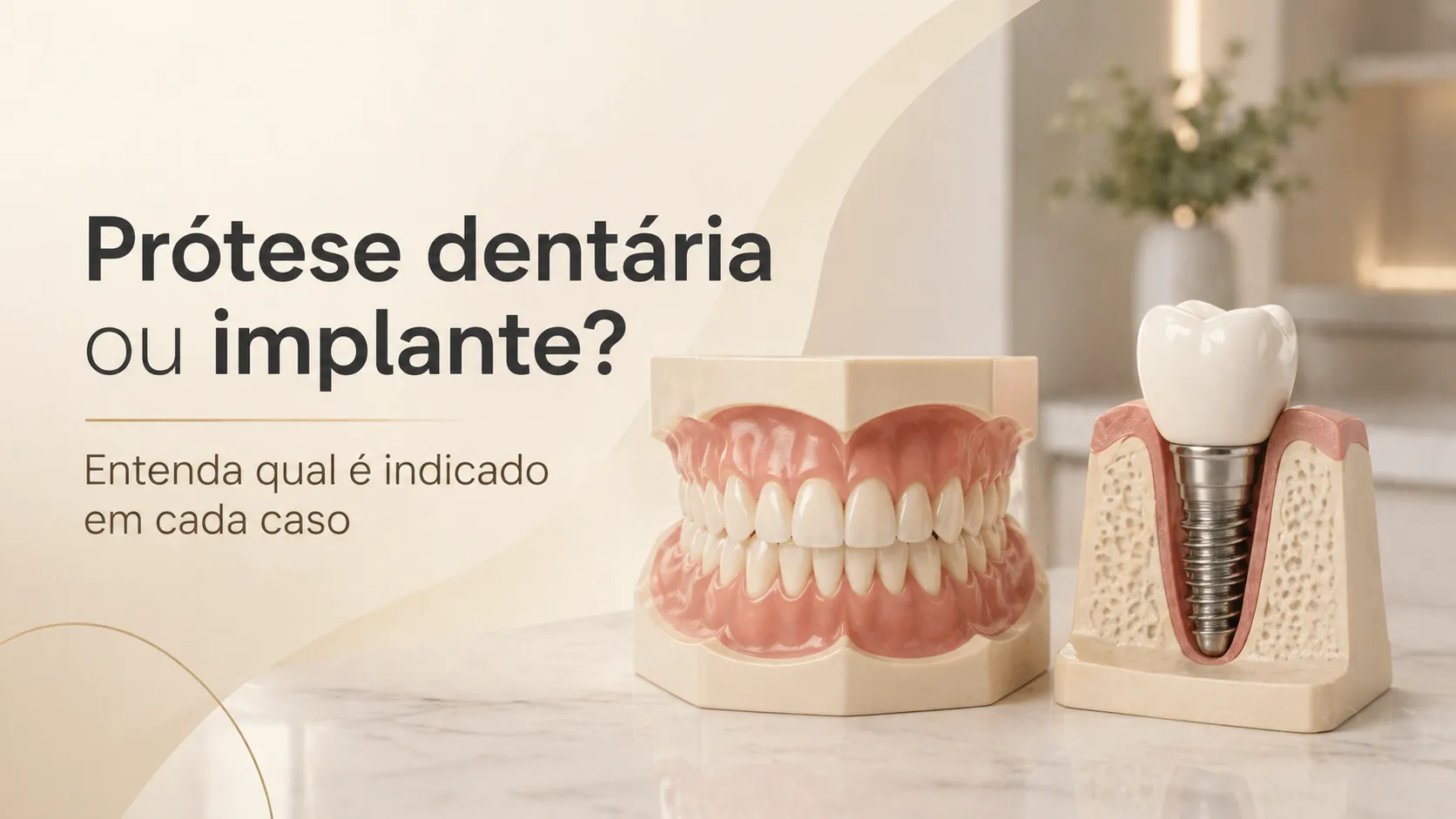 Prótese dentária ou implante em Curitiba para reabilitação oral